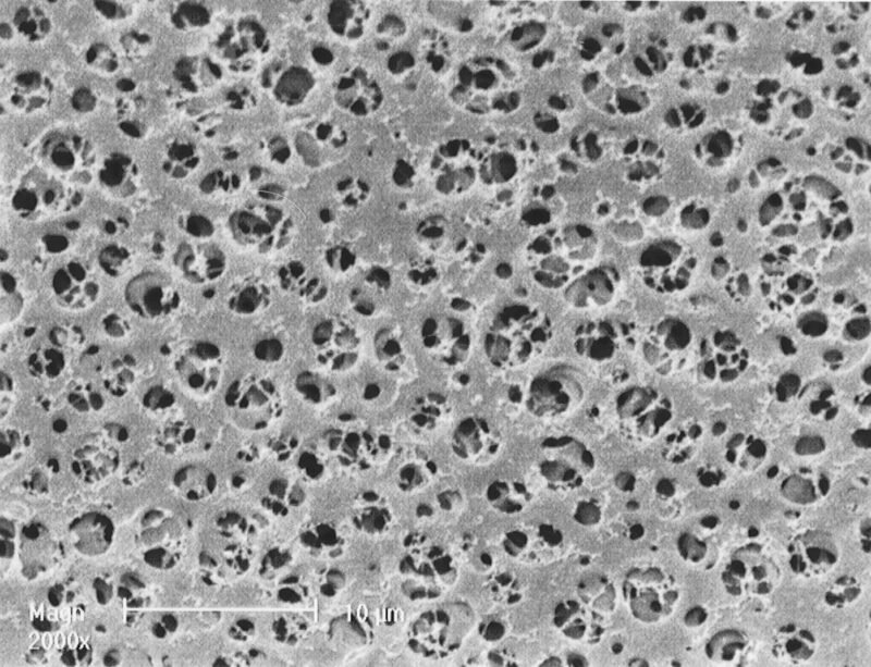 Filtro de membrana de acetato de celulosa (CA), 25mm diámetro 0.45µm poro, No estéril, x 100u.
