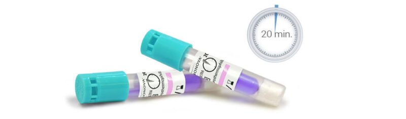 Indicador biológico de 20 min para vapor (FDA) x 50 u. - Imagen 3